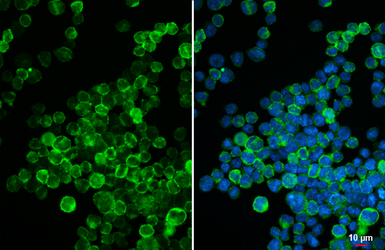 Anti-VEGF Receptor 3 antibody [HL5094] used in Immunocytochemistry/ Immunofluorescence (ICC/IF). GTX645284